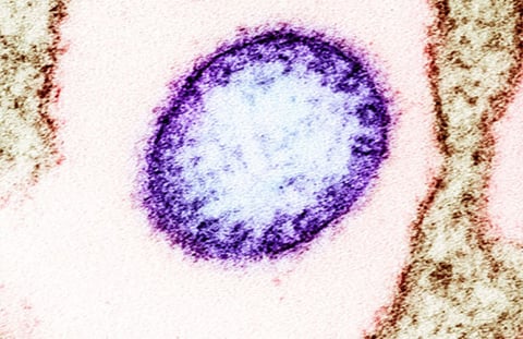 No Nipah virus cases in Baguio, health office assures