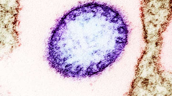 COLORIZED transmission electron micrograph na nagpapakita ng isang particle (purple) ng Nipah virus.