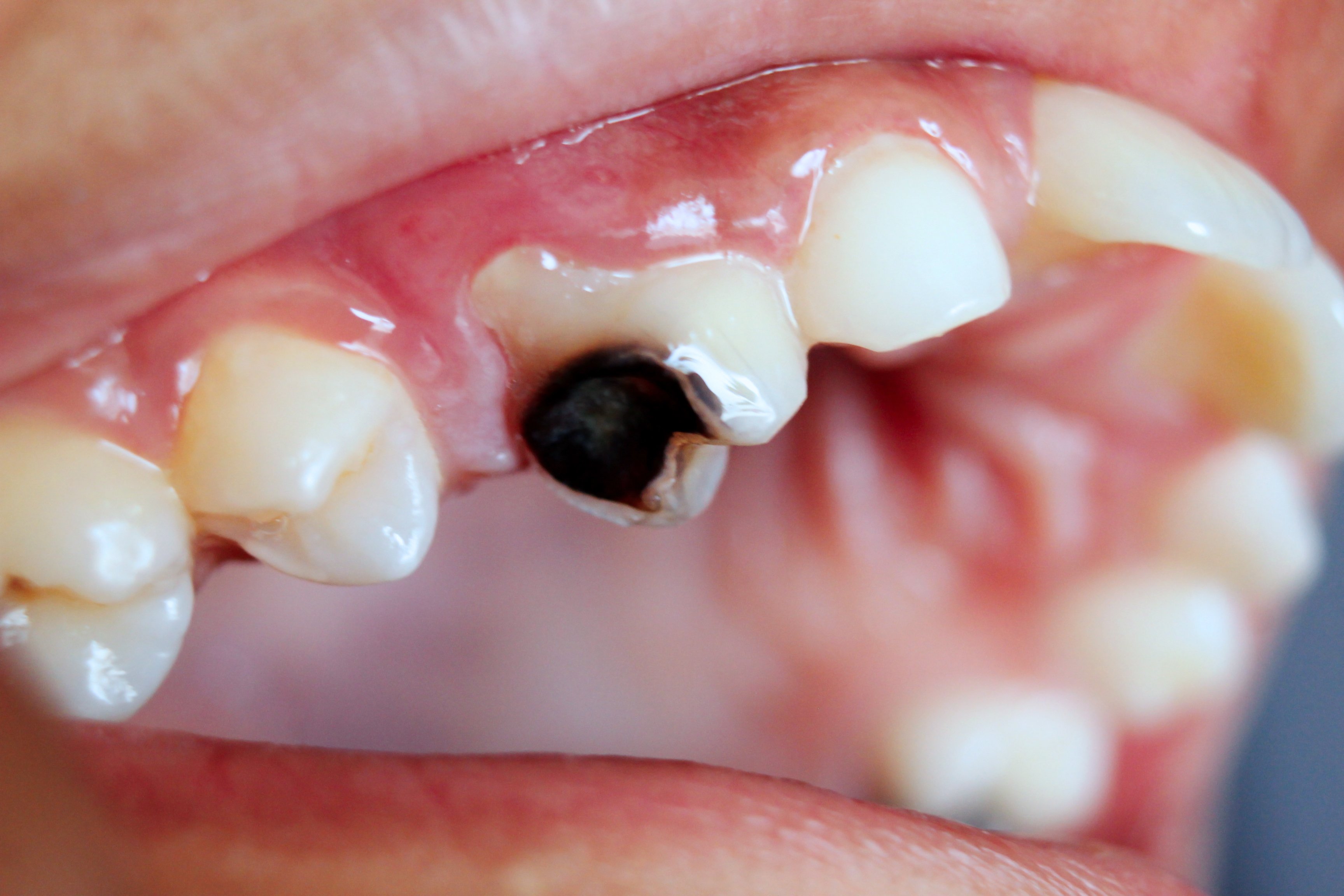 New global guidelines on dental care