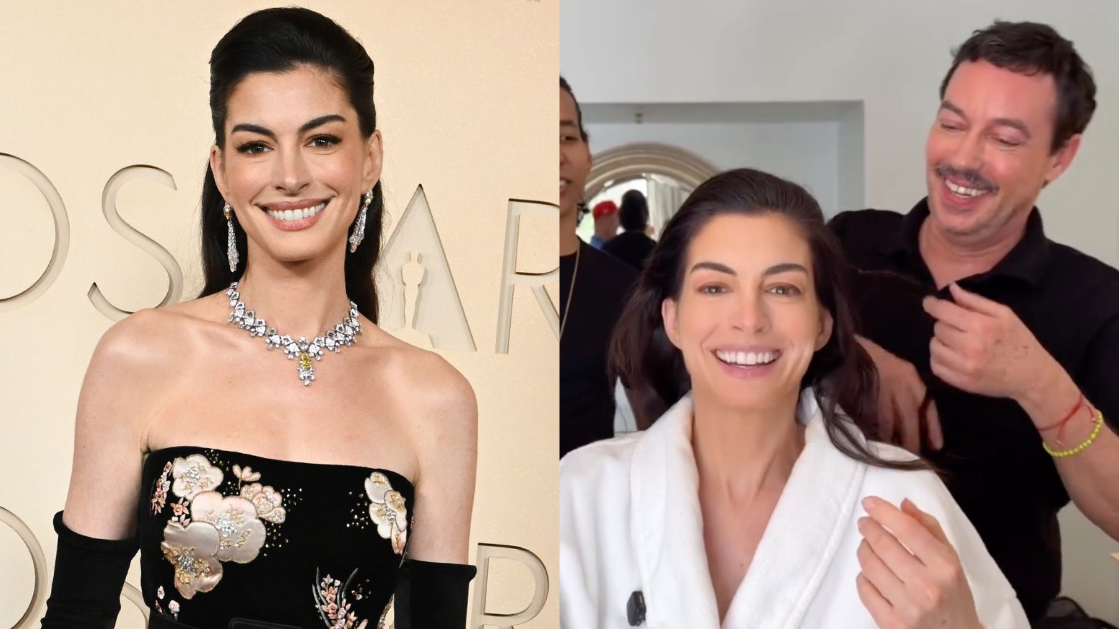 Steal this $0 facelift hiding in Anne Hathaway’s Oscars hairline