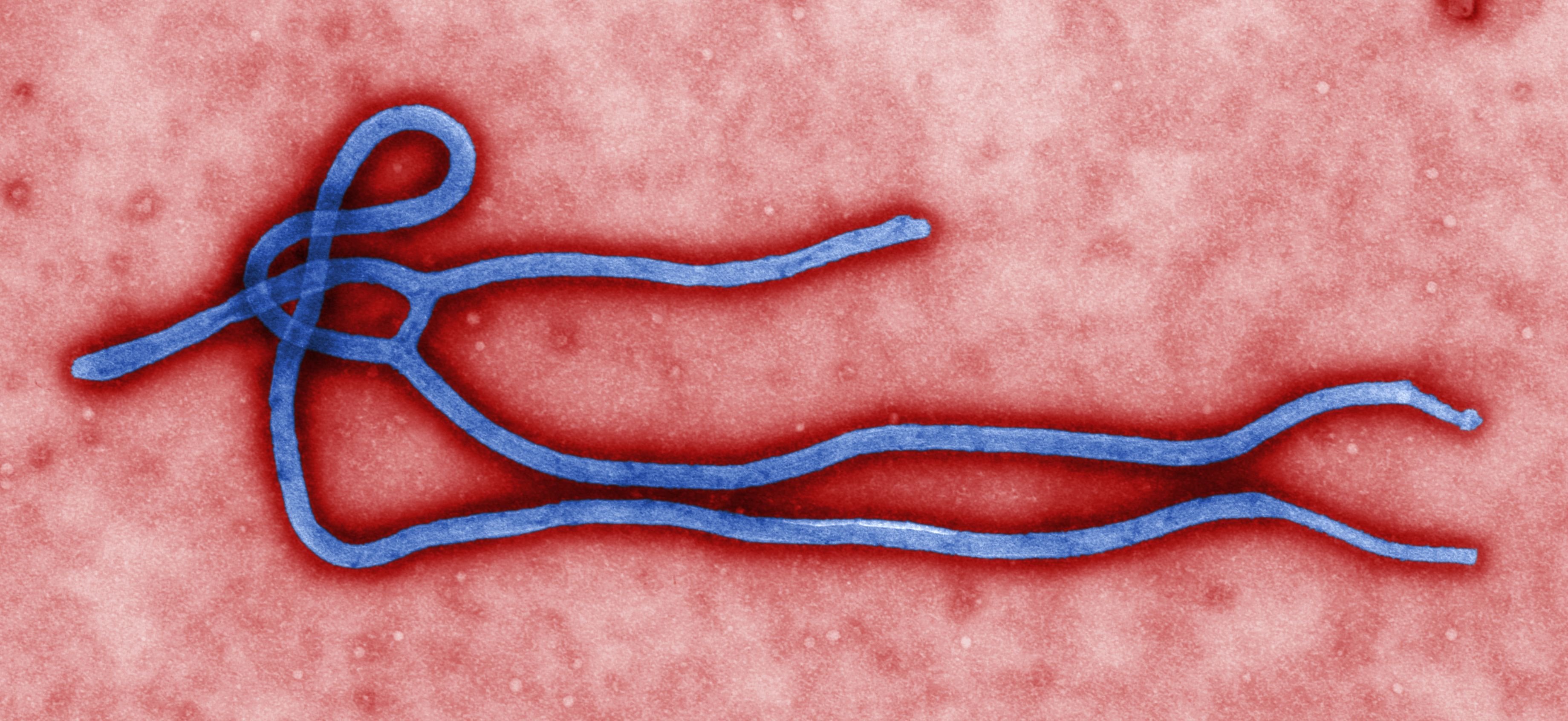 New deadly Ebola outbreak hits DR Congo, 1 dead in Uganda