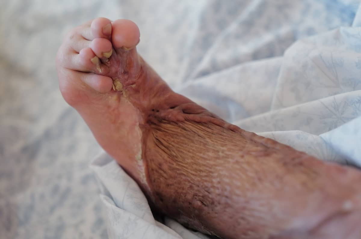 ‘The SCAR Project’ provides customized treatment and rehabilitation for individuals living with life-altering scars.