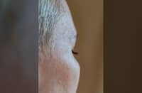 CHRONIC stress, poor nutrition, and certain medications may contribute to temporary or accelerated hair shedding.