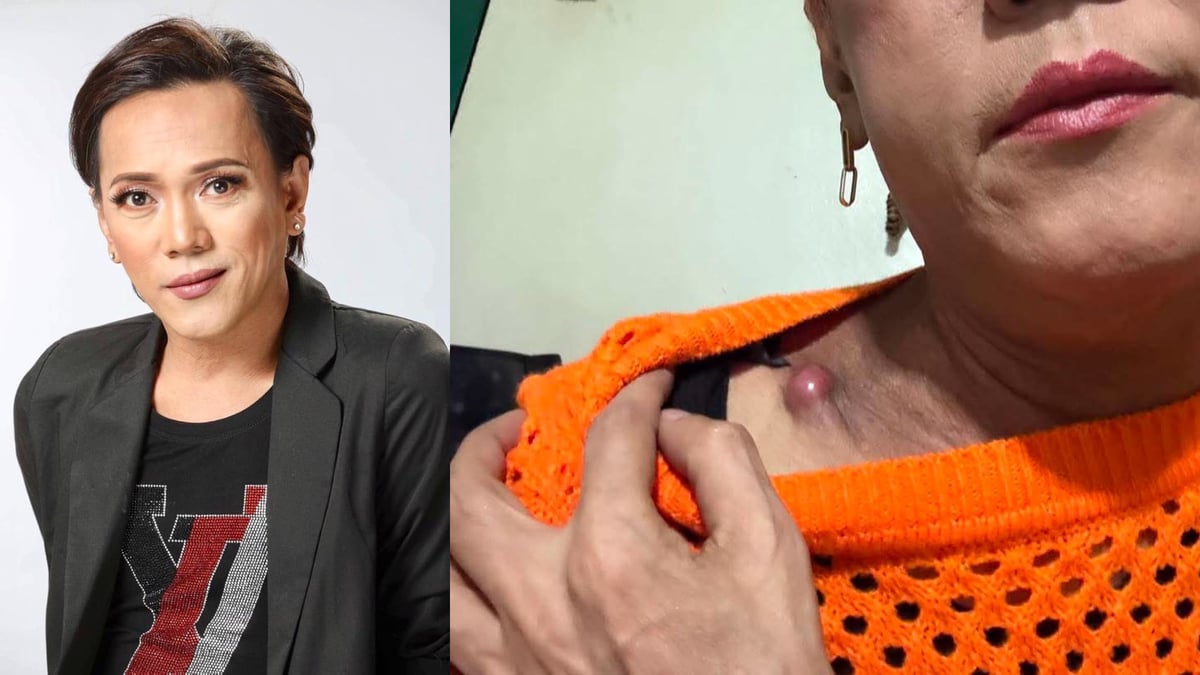 Ate Gay clarifies: 'I'm not cancer-free yet'