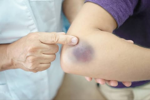 Cortisol is not the culprit