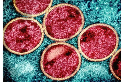 Guinea-Bissau faces mpox outbreak
