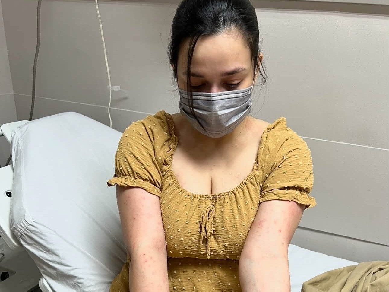 Yasmien Kurdi reveals skin reaction amid family stress