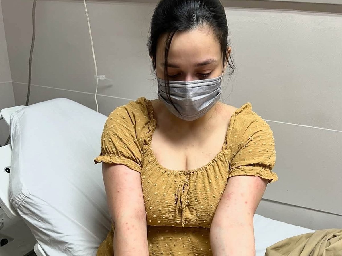 Yasmien Kurdi reveals skin reaction amid family stress