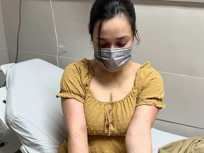 Yasmien Kurdi reveals skin reaction amid family stress