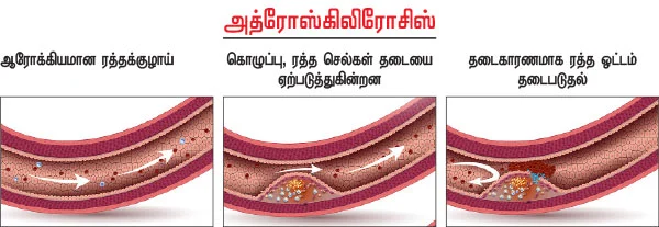 இனி நோ டென்ஷன்