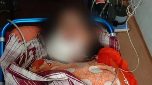 துப்பாக்கிக் குண்டு பாய்ந்து முகம் சிதைந்த ஹீனா